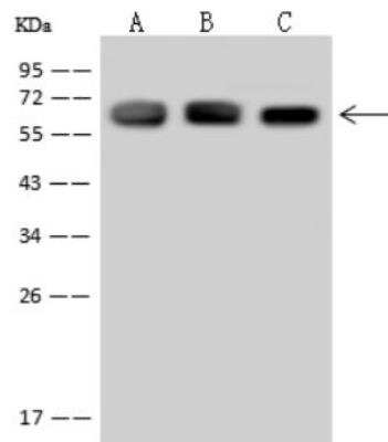 Western Blot: T Plastin Antibody [NBP3-06608] - Lane A: Raji Whole Cell Lysate Lane B: K562 Whole Cell Lysate Lane C: HT1080 Whole Cell Lysate Lysates/proteins at 30 ug per lane. Secondary Goat Anti-Rabbit IgG (H+L)/HRP at 1/10000 dilution. Developed using the ECL technique.Performed under reducing conditions. Predicted band size:70 kDa Observed band size:70 kDa