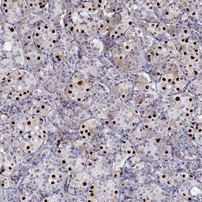 Immunohistochemistry-Paraffin: T-box 19 Antibody [NBP2-68943] - Staining of human pituitary gland shows strong nuclear positivity in glandular cells.