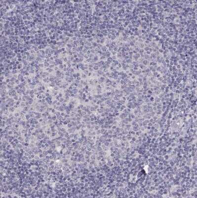 Immunohistochemistry-Paraffin: T-box 19 Antibody [NBP2-68943] - Staining of human tonsil shows no nuclear positivity in germinal center cells as expected.