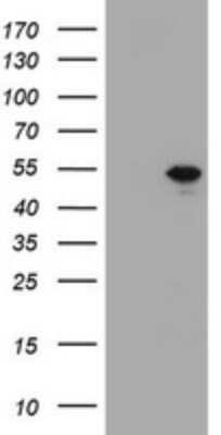 Western Blot: T-box 19 Antibody (OTI1C9) - Azide and BSA Free [NBP2-74469] - Analysis of HEK293T cells were transfected with the pCMV6-ENTRY control (Left lane) or pCMV6-ENTRY T-box 19.