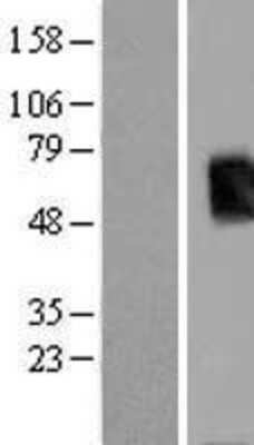 Western Blot: T-box 19 Overexpression Lysate (Adult Normal) [NBL1-16745] Left-Empty vector transfected control cell lysate (HEK293 cell lysate); Right -Over-expression Lysate for T-box 19.