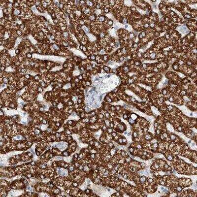 Immunohistochemistry-Paraffin: T2R60 Antibody [NBP1-86975] - Staining of human liver shows cytoplasmic positivity in hepatocytes.