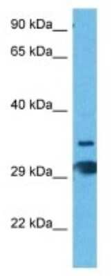 Western Blot: T2R60 Antibody [NBP3-10219] - Western blot analysis of T2R60 in Mouse Kidney lysates. Antibody dilution at 1ug/ml