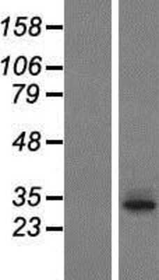 Western Blot: T2R60 Overexpression Lysate (Adult Normal) [NBP2-05039] Left-Empty vector transfected control cell lysate (HEK293 cell lysate); Right -Over-expression Lysate for T2R60.