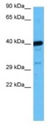 Western Blot: TAAR4 Antibody [NBP3-10140] - Western blot analysis of TAAR4 in Rat Kidney lysates. Antibody dilution at 1ug/ml