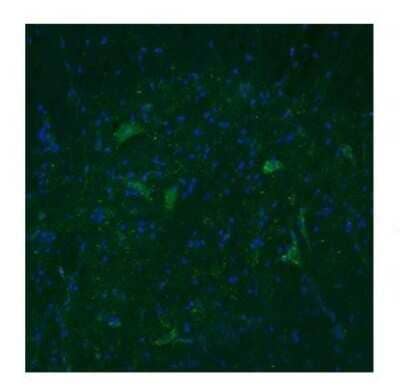 Immunohistochemistry: TAAR5 Antibody [NBP1-69132] - Dilution -- 3ug/mL