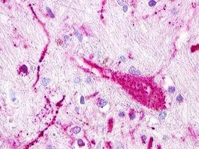 Immunohistochemistry: TAAR5 Antibody [NLS319] - Analysis of anti-TAAR5 antibody with brain, neuron.
