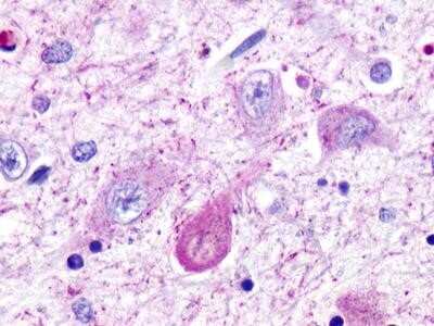 Immunohistochemistry-Paraffin: TAAR5 Antibody [NLS320] - Analysis of anti-TAAR5 antibody with human brain, thalamus, neurons and glia.