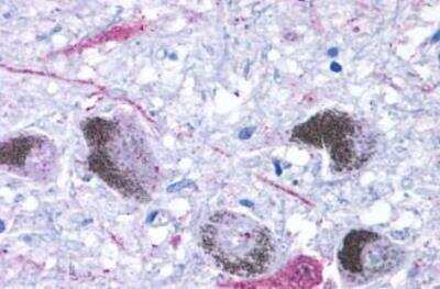 Immunohistochemistry-Paraffin: TAAR9 Antibody [NLS1969] - Brain, Substantia Nigra, neurons.