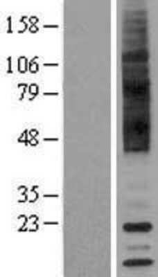 Western Blot: TAAR9 Overexpression Lysate (Adult Normal) [NBP2-04436] Left-Empty vector transfected control cell lysate (HEK293 cell lysate); Right -Over-expression Lysate for TAAR9.