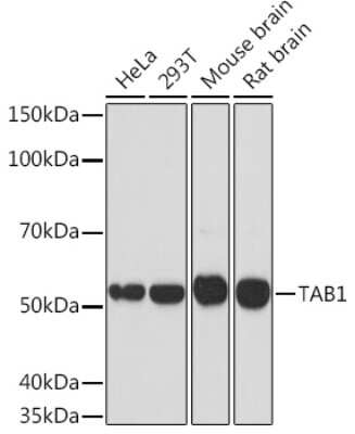 Western Blot: TAB1 Antibody (2W0P2) [NBP3-16167] - Western blot analysis of extracts of various cell lines, using TAB1 Rabbit mAb (NBP3-16167) at 1:1000 dilution. Secondary antibody: HRP Goat Anti-Rabbit IgG (H+L) at 1:10000 dilution. Lysates/proteins: 25ug per lane. Blocking buffer: 3% nonfat dry milk in TBST. Detection: ECL Basic Kit. Exposure time: 90s.