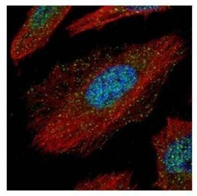 Immunocytochemistry/Immunofluorescence: TAB1 Antibody [NBP2-20552] - Confocal immunofluorescence analysis of paraformaldehyde-fixed HeLa, using TAB1 antibody (Green) at 1:500 dilution. Alpha-tubulin filaments are labeled with Alpha-tubulin antibody (Red) at 1:2000.
