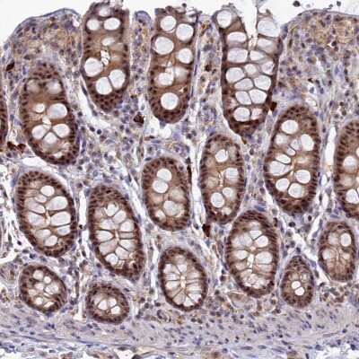 Immunohistochemistry-Paraffin: TAB1 Antibody [NBP2-38458] - Staining of human colon shows moderate dot-like nuclear and cytoplasmic positivity in glandular cells.