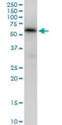 Western Blot: TAB1 Antibody [H00010454-B01P] - Analysis of MAP3K7IP1 expression in HeLa.