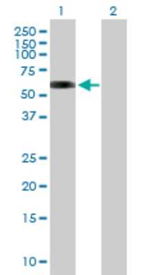 Western Blot: TAB1 Antibody [H00010454-B01P] - Analysis of MAP3K7IP1 expression in transfected 293T cell line by MAP3K7IP1 polyclonal antibody.  Lane 1: MAP3K7IP1 transfected lysate(54.60 KDa). Lane 2: Non-transfected lysate.