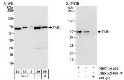 Western Blot: TAB1 Antibody [NBP1-21405] - Whole cell  lysate from HeLa, 293T, and mouse NIH3T3 cells. NBP1-21405 used for WB at 0.04 mcg/ml (A) and 1 mcg/ml (B) and used for IP at 3 mcg/mg lysate.