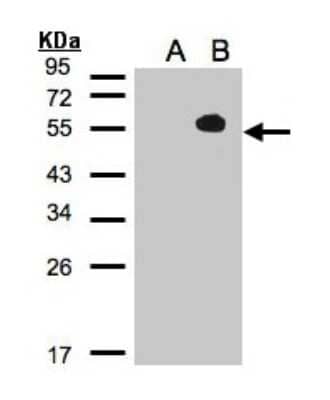 Western Blot: TAB1 Antibody [NBP2-20552] - Expression in transfected 293T cell line by MAP3K7IP1 polyclonal antibody. A: Non-transfected lysate. B: TAB1 transfected lysate. 12% SDS PAGE gel, diluted at 1:500.