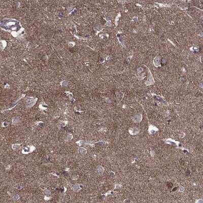 Immunohistochemistry: TAB2 Antibody [NBP2-68895] - Immunohistochemical staining of human cerebral cortex shows cytoplasmic positivity in neuronal cells and neuropil.