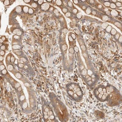 Immunohistochemistry-Paraffin TACC1 Antibody - BSA Free