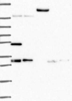 Western Blot TACC1 Antibody - BSA Free