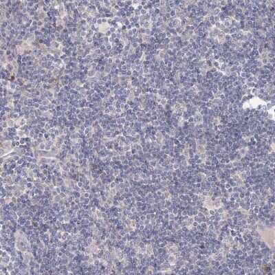 Immunohistochemistry-Paraffin: TACC2 Antibody [NBP1-88926] - Staining of human lymph node shows low expression as expected.