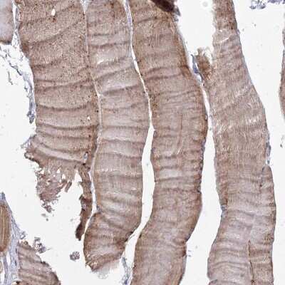Immunohistochemistry-Paraffin: TACC2 Antibody [NBP1-88926] - Staining of human skeletal muscle shows high expression.