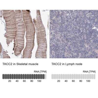 <b>Orthogonal Strategies Validation. </b>Immunohistochemistry-Paraffin: TACC2 Antibody [NBP1-88926] - Staining in human skeletal muscle and lymph node tissues using anti-TACC2 antibody. Corresponding TACC2 RNA-seq data are presented for the same tissues.