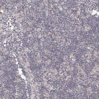 Immunohistochemistry-Paraffin: TACC2 Antibody [NBP2-38173] - Staining of human lymph node shows low expression as expected.
