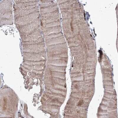 Immunohistochemistry-Paraffin: TACC2 Antibody [NBP2-38173] - Staining of human skeletal muscle shows high expression.