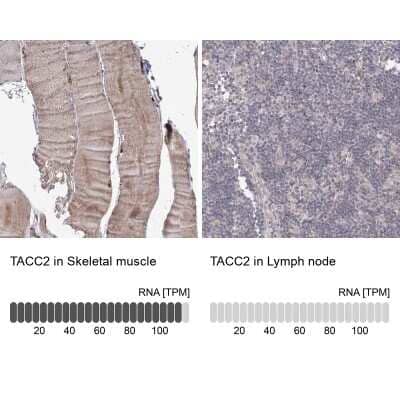 <b>Orthogonal Strategies Validation. </b>Immunohistochemistry-Paraffin: TACC2 Antibody [NBP2-38173] - Staining in human skeletal muscle and lymph node tissues using anti-TACC2 antibody. Corresponding TACC2 RNA-seq data are presented for the same tissues.