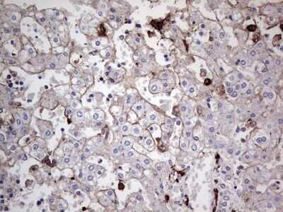 Immunohistochemistry: TACC2 Antibody (OTI3C4) - Azide and BSA Free [NBP2-74430] - Analysis of Human embryonic liver tissue.(Heat-induced epitope retrieval by 1 mM EDTA in 10mM Tris, pH8.5, 120C for 3min)
