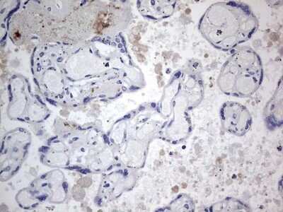 Immunohistochemistry: TACC2 Antibody (OTI3C4) - Azide and BSA Free [NBP2-74430] - Analysis of Human placenta tissue. (Heat-induced epitope retrieval by 1 mM EDTA in 10mM Tris, pH8.5, 120C for 3min)