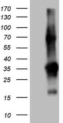 Western Blot: TACC2 Antibody (OTI3C4) - Azide and BSA Free [NBP2-74430] - Human recombinant protein fragment corresponding to amino acids 727-1026 of human TACC2 (NP_008928) produced in E.coli.