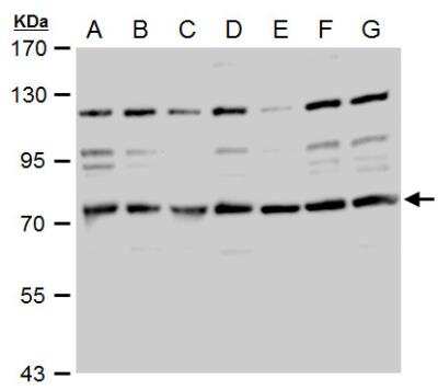 Western Blot: TACC2 Antibody [NBP1-31221] - A. 30 ug 293T whole cell extract B. 30 ug A431 whole cell extract C. 30 ug H1299 whole cell extract D. 30 ug HeLa whole cell extract E. 30 ug HepG2 whole cell extract F. 30 ug Molt-4 whole cell extract G. 30 ug Raji whole cell extract 7.5 % SDS-PAGE TACC2 antibody dilution: 1:1000