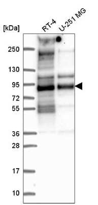 Western Blot: TACC2 Antibody [NBP2-57227] - Western blot analysis in human cell line RT-4 and human cell line U-251 MG.