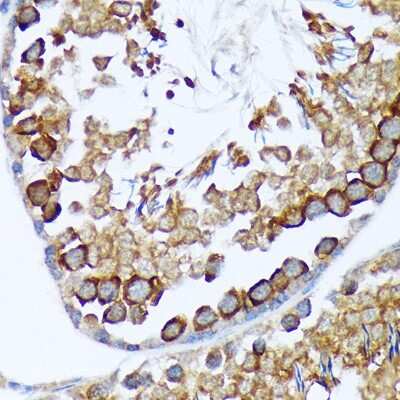 Immunohistochemistry-Paraffin: TACC3 Antibody (7S7L2) [NBP3-15816] - Immunohistochemistry of paraffin-embedded rat testis using TACC3 Rabbit mAb (NBP3-15816) at dilution of 1:100 (40x lens).Perform microwave antigen retrieval with 10 mM Tris/EDTA buffer pH 9.0 before commencing with IHC staining protocol.