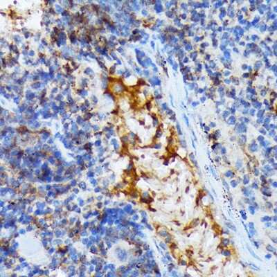 Immunohistochemistry-Paraffin: TACC3 Antibody (7S7L2) [NBP3-15816] - Immunohistochemistry of paraffin-embedded mouse spleen using TACC3 Rabbit mAb (NBP3-15816) at dilution of 1:100 (40x lens).Perform microwave antigen retrieval with 10 mM Tris/EDTA buffer pH 9.0 before commencing with IHC staining protocol.