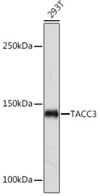 Western Blot TACC3 Antibody (7S7L2)