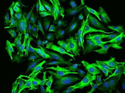 Immunocytochemistry/Immunofluorescence: TACC3 Antibody [NBP2-97500] - Immunofluorescence staining of TACC3 in U251MG cells. Cells were fixed with 4% PFA, permeabilzed with 0.1% Triton X-100 in PBS, blocked with 10% serum, and incubated with rabbit anti-Human TACC3 polyclonal antibody (dilution ratio 1:200) at 4C overnight. Then cells were stained with the Alexa Fluor(R)488-conjugated Goat Anti-rabbit IgG secondary antibody (green) and counterstained with DAPI (blue).Positive staining was localized to Cytoplasm.