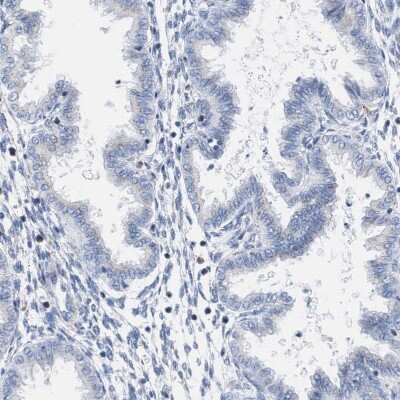 Immunohistochemistry-Paraffin: TACC3 Antibody [NBP1-84810] - Staining of human endometrium shows low expression as expected.