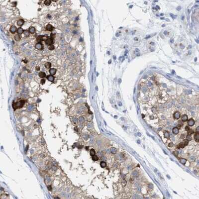 Immunohistochemistry-Paraffin: TACC3 Antibody [NBP1-84810] - Staining of human testis shows high expression.