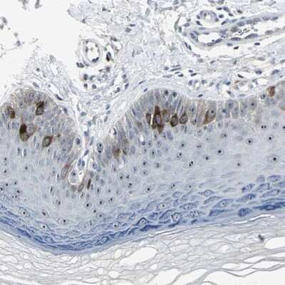 Immunohistochemistry-Paraffin: TACC3 Antibody [NBP1-84811] - Staining of human skin shows strong nuclear and cytoplasmic positivity in epidermal cells.