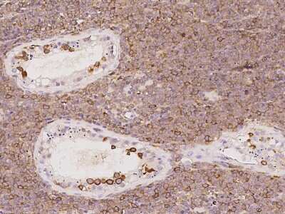 Immunohistochemistry-Paraffin: TACC3 Antibody [NBP2-97500] - Immunochemical staining of human TACC3 in human testis with rabbit polyclonal antibody at 1:100 dilution, formalin-fixed paraffin embedded sections.