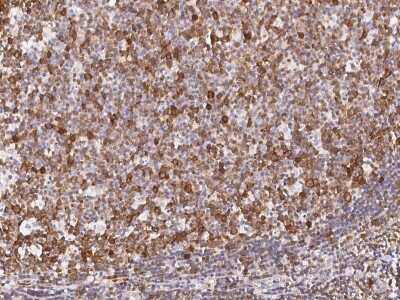 Immunohistochemistry-Paraffin: TACC3 Antibody [NBP2-98919] - Immunochemical staining of human TACC3 in human testis with rabbit polyclonal antibody (1:1000, formalin-fixed paraffin embedded sections).