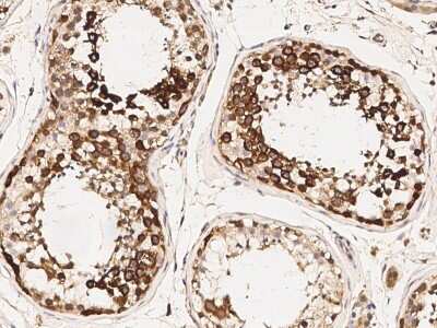 Immunohistochemistry-Paraffin: TACC3 Antibody [NBP2-98919] - Immunochemical staining of human TACC3 in human tonsil with rabbit polyclonal antibody (1:1000, formalin-fixed paraffin embedded sections).