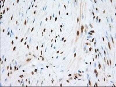 Immunohistochemistry: TACC3 Antibody (OTI6F1) - Azide and BSA Free [NBP2-74436] - Staining of paraffin-embedded Human colon tissue using anti-TACC3 mouse monoclonal antibody.