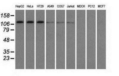 Western Blot: TACC3 Antibody (OTI6F1) - Azide and BSA Free [NBP2-74436] - Analysis of extracts (35ug) from 9 different cell lines by using anti-TACC3 monoclonal antibody.