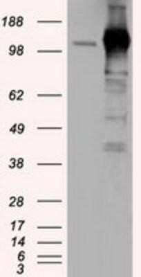Western Blot: TACC3 Antibody (OTI6F1) - Azide and BSA Free [NBP2-74436] - HEK293T cells were transfected with the pCMV6-ENTRY control (Left lane) or pCMV6-ENTRY TACC3 (Right lane) cDNA for 48 hrs and lysed. Equivalent amounts of cell lysates (5 ug per lane) were separated by SDS-PAGE and immunoblotted with anti-TACC3.
