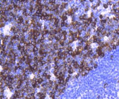 Immunohistochemistry-Paraffin: TACC3 Antibody (SN73-05) [NBP2-67671] - Analysis of paraffin-embedded human tonsil tissue using anti-TACC3 antibody. Counter stained with hematoxylin.
