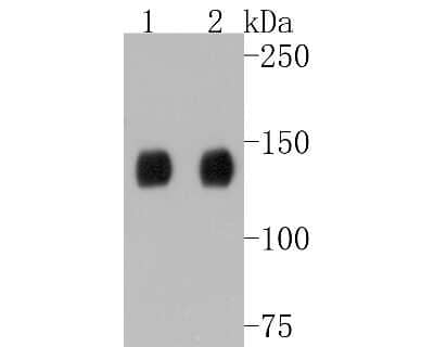 Western Blot: TACC3 Antibody (SN73-05) [NBP2-67671] - Western blot analysis of TACC3 on different lysates. Proteins were transferred to a PVDF membrane and blocked with 5% BSA in PBS for 1 hour at room temperature. The primary antibody (1/500) was used in 5% BSA at room temperature for 2 hours. Goat Anti-Rab